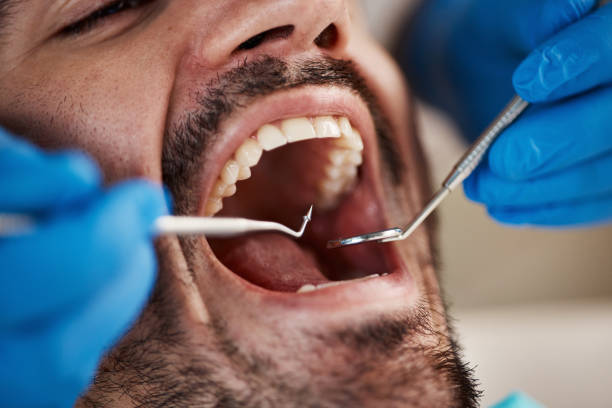 Best Walk-In Emergency Dentist in Cementon, PA